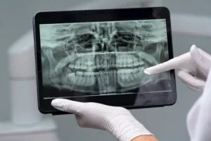 digital teeth x ray