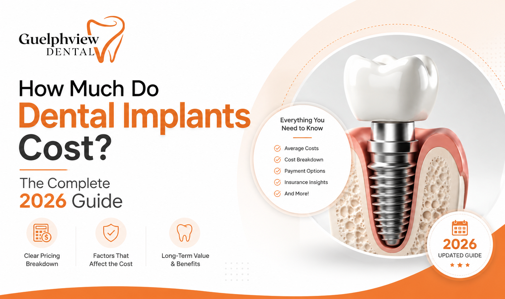 dental implants